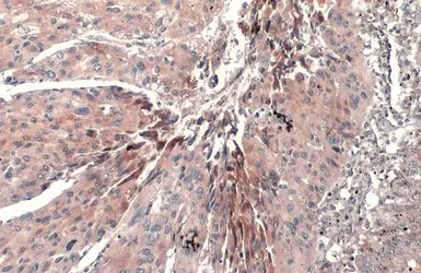 Anti-CETP antibody [N1N3] used in IHC (Paraffin sections) (IHC-P). GTX113162