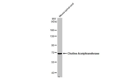 Anti-Choline Acetyltransferase antibody [N1N3] used in Western Blot (WB). GTX113164