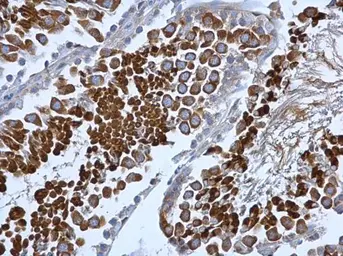 Anti-COPB antibody [N1N2], N-term used in IHC (Paraffin sections) (IHC-P). GTX113167