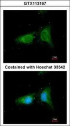 Anti-COPB antibody [N1N2], N-term used in Immunocytochemistry/ Immunofluorescence (ICC/IF). GTX113167