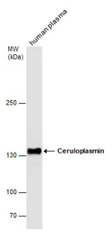 Anti-Ceruloplasmin antibody [N1N2], N-term used in Western Blot (WB). GTX113168