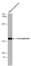 Anti-Ceruloplasmin antibody [N1N2], N-term used in Western Blot (WB). GTX113168