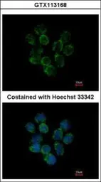 Anti-Ceruloplasmin antibody [N1N2], N-term used in Immunocytochemistry/ Immunofluorescence (ICC/IF). GTX113168