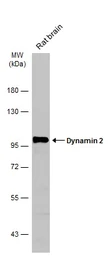 Anti-Dynamin 2 antibody [N1N3] used in Western Blot (WB). GTX113171