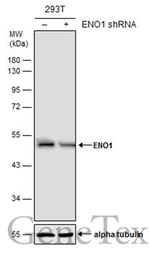 Anti-ENO1 antibody used in Western Blot (WB). GTX113179