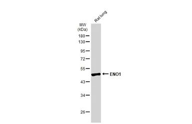 Anti-ENO1 antibody used in Western Blot (WB). GTX113179
