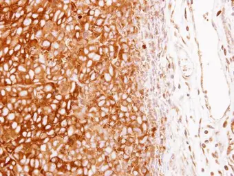 Anti-G6PD antibody [N2C1], Internal used in IHC (Paraffin sections) (IHC-P). GTX113186