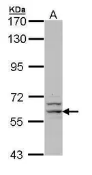 Anti-G6PD antibody [N2C1], Internal used in Western Blot (WB). GTX113186
