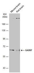 Anti-GAD67 antibody used in Western Blot (WB). GTX113190