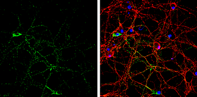 Anti-GAD65 antibody used in Immunocytochemistry/ Immunofluorescence (ICC/IF). GTX113192