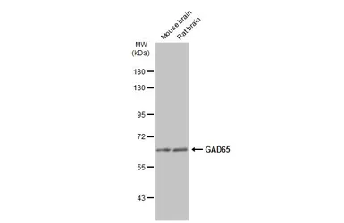 Anti-GAD65 antibody used in Western Blot (WB). GTX113192