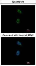 Anti-GATA4 antibody used in Immunocytochemistry/ Immunofluorescence (ICC/IF). GTX113194