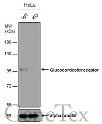 Anti-Glucocorticoid Receptor antibody used in Western Blot (WB). GTX113208
