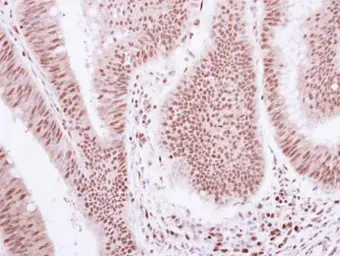 Anti-Glucocorticoid Receptor antibody used in IHC (Paraffin sections) (IHC-P). GTX113208