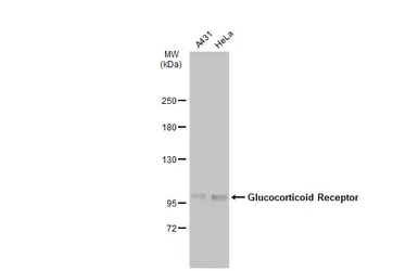 Anti-Glucocorticoid Receptor antibody used in Western Blot (WB). GTX113208