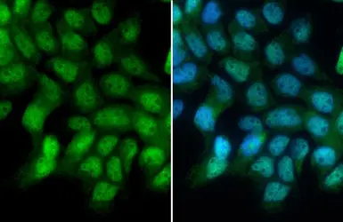 Anti-Glucocorticoid Receptor antibody used in Immunocytochemistry/ Immunofluorescence (ICC/IF). GTX113208