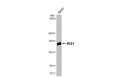 Anti-IRS1 antibody [C2C3], C-term used in Western Blot (WB). GTX113213