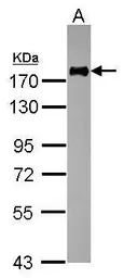 Anti-CD11a antibody [N1N3] used in Western Blot (WB). GTX113214