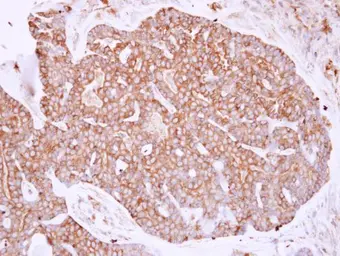 Anti-MYH9 antibody [N1-2], N-term used in IHC (Paraffin sections) (IHC-P). GTX113236