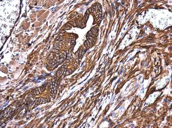 Anti-MYH9 antibody [N1-2], N-term used in IHC (Paraffin sections) (IHC-P). GTX113236