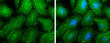 Anti-MYH9 antibody [N1-2], N-term used in Immunocytochemistry/ Immunofluorescence (ICC/IF). GTX113236