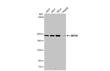 Anti-MYH9 antibody [N1-2], N-term used in Western Blot (WB). GTX113236