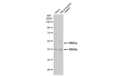 Anti-PBX1 antibody used in Western Blot (WB). GTX113242