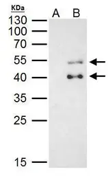 Anti-PBX1 antibody used in Immunoprecipitation (IP). GTX113242