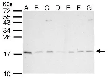 Anti-PIN1 antibody [N1C3-2] used in Western Blot (WB). GTX113245