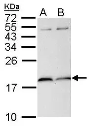 Anti-PIN1 antibody [N1C3-2] used in Western Blot (WB). GTX113245