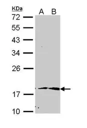 Anti-PIN1 antibody [N1C3-2] used in Western Blot (WB). GTX113245