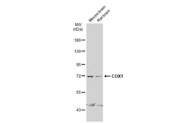 Anti-COX1 antibody used in Western Blot (WB). GTX113259