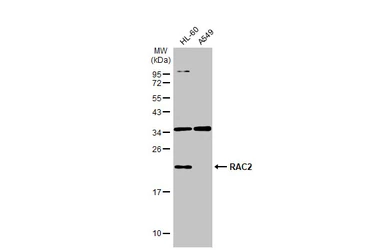 Anti-RAC2 antibody [N1C3] used in Western Blot (WB). GTX113262
