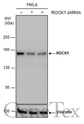 Anti-ROCK1 antibody [N1N2], N-term used in Western Blot (WB). GTX113266