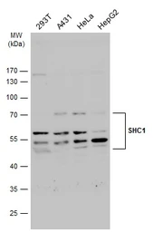 Anti-SHC1 antibody [N3C2], Internal used in Western Blot (WB). GTX113267