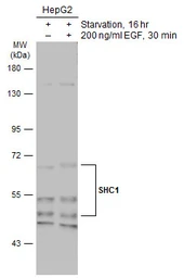 Anti-SHC1 antibody [N3C2], Internal used in Western Blot (WB). GTX113267