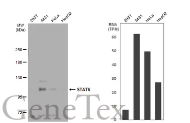 Anti-STAT6 antibody used in Western Blot (WB). GTX113273