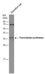 Anti-Thymidylate synthase antibody [N3C3] used in Western Blot (WB). GTX113289