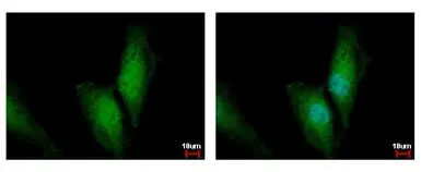 Anti-UBE2N antibody used in Immunocytochemistry/ Immunofluorescence (ICC/IF). GTX113290