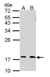 Anti-UBE2N antibody used in Western Blot (WB). GTX113290
