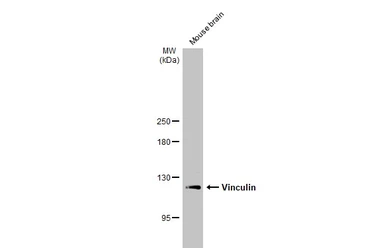 Anti-Vinculin antibody [N1N3] used in Western Blot (WB). GTX113294