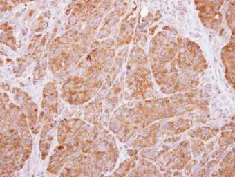 Anti-14-3-3 beta antibody [N1C2] used in IHC (Paraffin sections) (IHC-P). GTX113296