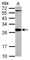 Anti-14-3-3 beta antibody [N1C2] used in Western Blot (WB). GTX113296