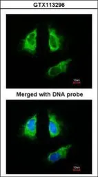 Anti-14-3-3 beta antibody [N1C2] used in Immunocytochemistry/ Immunofluorescence (ICC/IF). GTX113296