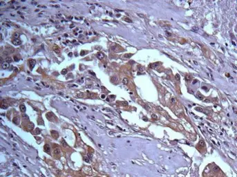Anti-14-3-3 beta antibody [N1C3] used in IHC (Paraffin sections) (IHC-P). GTX113297
