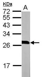 Anti-14-3-3 beta antibody [N1C3] used in Western Blot (WB). GTX113297