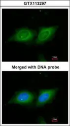 Anti-14-3-3 beta antibody [N1C3] used in Immunocytochemistry/ Immunofluorescence (ICC/IF). GTX113297