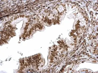 Anti-SMC1A antibody used in IHC (Paraffin sections) (IHC-P). GTX113299