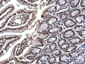 Anti-SMC1A antibody used in IHC (Paraffin sections) (IHC-P). GTX113299