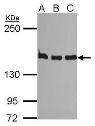 Anti-SMC1A antibody used in Western Blot (WB). GTX113299